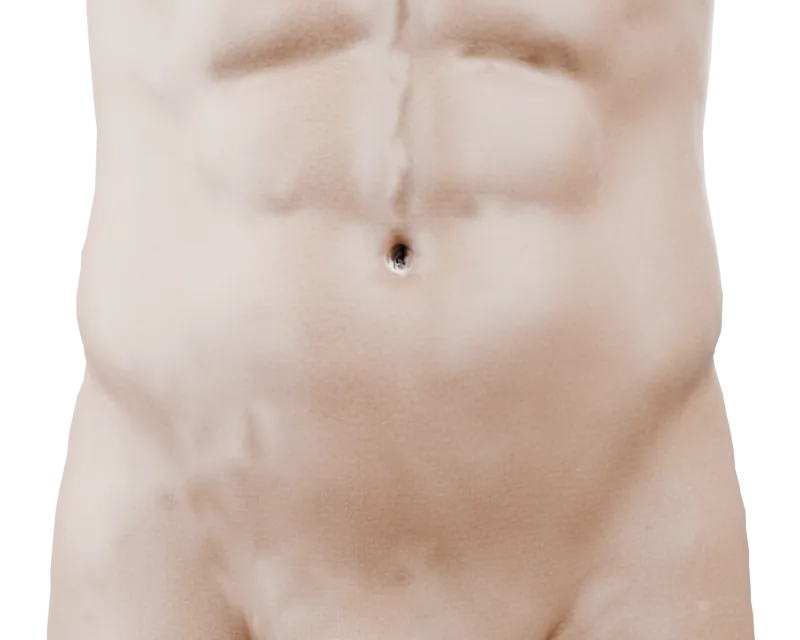 Representación educativa del abdomen para ubicar distintos tipos de hernia